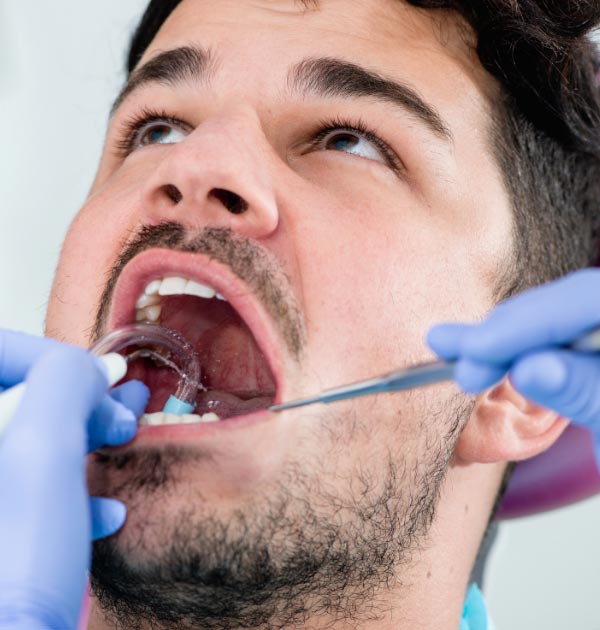 Zahnärztliche Behandlung zur Entfernung von Zahnstein bei männlichem Patienten